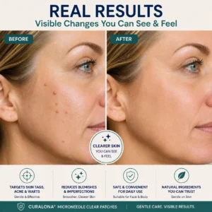 Curalona™ Skin Renewal Patch