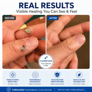 Curalona™ Skin Renewal Patch