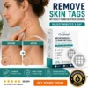 ✨Curalona®2-in-1 Microneedle & Hydrocolloid Patch🍀| Removes Raised Moles, Acne, Flat Warts & Skin Tags | Helps Improve Wrinkles, Scars & Blemishes | Invisible Patches for Face & Body
 – Gravelreign