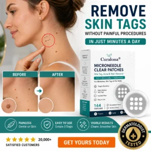 ✨Curalona®2-in-1 Microneedle & Hydrocolloid Patch🍀| Removes Raised Moles, Acne, Flat Warts & Skin Tags | Helps Improve Wrinkles, Scars & Blemishes | Invisible Patches for Face & Body
 – Gravelreign