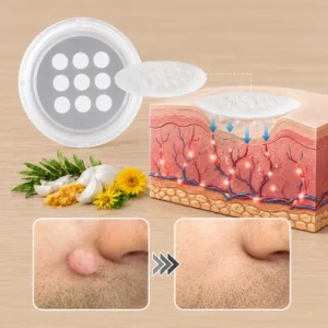 ✨Curalona®2-in-1 Microneedle & Hydrocolloid Patch🍀| Removes Raised Moles, Acne, Flat Warts & Skin Tags | Helps Improve Wrinkles, Scars & Blemishes | Invisible Patches for Face & Body
 – Gravelreign