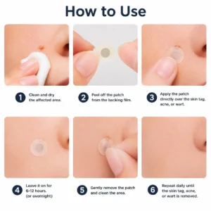 ✨Curalona®2-in-1 Microneedle & Hydrocolloid Patch🍀| Removes Raised Moles, Acne, Flat Warts & Skin Tags | Helps Improve Wrinkles, Scars & Blemishes | Invisible Patches for Face & Body
 – Gravelreign