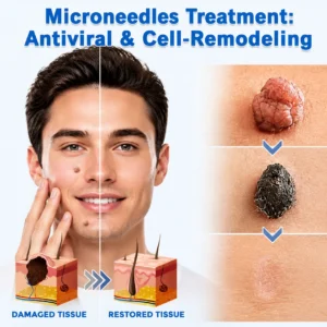 ✨Curalona®2-in-1 Microneedle & Hydrocolloid Patch🍀| Removes Raised Moles, Acne, Flat Warts & Skin Tags | Helps Improve Wrinkles, Scars & Blemishes | Invisible Patches for Face & Body
 – Gravelreign