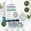 ✨Curalona® 2-in-1 Microneedle & Hydrocolloid Patch🍀 | Removes raised moles, acne, flat warts, and skin tags | Helps improve wrinkles, scars, and blemishes | Invisible patches for face and body