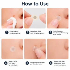 ✨Curalona® 2-in-1 Microneedle & Hydrocolloid Patch🍀 | Removes raised moles, acne, flat warts, and skin tags | Helps improve wrinkles, scars, and blemishes | Invisible patches for face and body